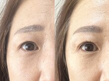 カーム(calm)/～50代のお客様の変化～