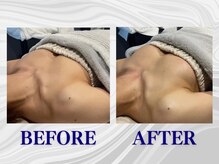 ザモア 福岡天神(THE MORE)/【症例 Before After】