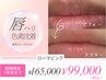 【40％OFF・アフタークリーム付き】唇黒ずみケア/ローマピンク　99,000