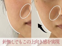 モアビューティーエステ 本通り店(MORE BEAUTY ESTHE)