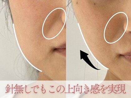 モアビューティーエステ 本通り店(MORE BEAUTY ESTHE)の写真