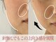 モアビューティーエステ 本通り店(MORE BEAUTY ESTHE)の写真