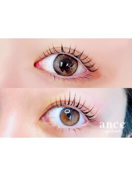 まつげのお悩み解決サロン