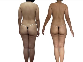 オリーブ(Olive)/4ヶ月のビフォーアフター