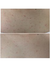 ミーフォレスト(Mi Forest)/