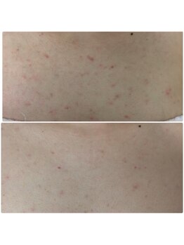 ミーフォレスト(Mi Forest)/