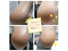 からだめぐりサロン 陽まわりの雰囲気（5～8月期間限定☆角質ケア＆足専用パックで足元集中ケアメニュー）