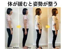 テルケル 佐賀の雰囲気(自律神経の乱れ、不眠、肩こり解消で疲れて見える姿勢から卒業)