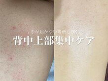 ルアナアイナ 大分の雰囲気（背中、二の腕、ヒップなどのBodyハーブもお任せください！）