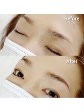 マツ(MATSU)/【ハリウッドブロウリフト】