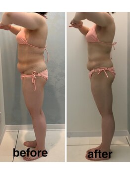 アールボディバランス/【3ヶ月モニター様】