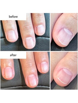 ケアプラス(care plus)/ハンドネイルケア