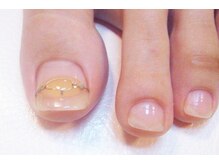 フットブルー横浜店/オプション【巻き爪ケア】