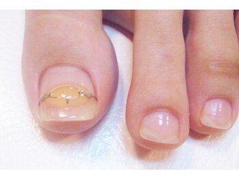フットブルー横浜店/オプション【巻き爪ケア】