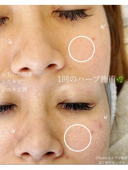 アノ(a'no)/韓国肌管理