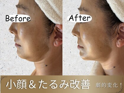 エマーチェ 自由が丘(emmace)の写真