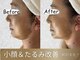エマーチェ 自由が丘(emmace)の写真