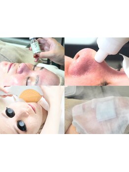 ハリツヤをUPしたい