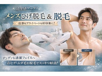 アンダンテ(Andante)/メンズ脱毛