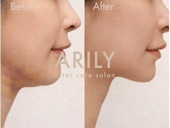 アリリィ(ARILY)/ARILY after care salon