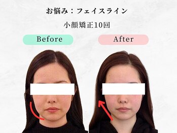 美容整体ウェリナ あま甚目寺院/小顔矯正/骨盤矯正/美脚サロン