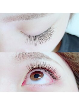 私のビューティー/バインドロック