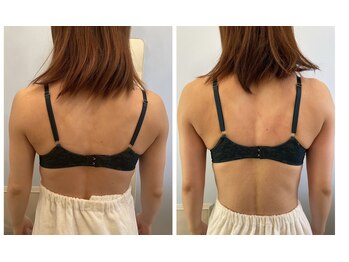 メゾン アンジュ(Maison Ange)/バストアップ症例【背中】バスト