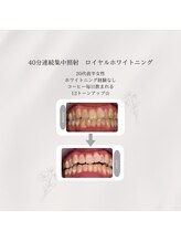 プラスビーセルフ(+b self)/ホワイトニングビフォーアフター