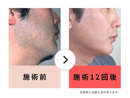 ヘアーアトリエ モアナ(Moana)の写真