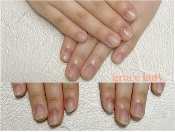 グレースレディ/ネイルができなくても、、、