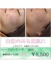 《肌質改善/肌管理》特許取得◎天然成分のハーブピーリング70分¥8500