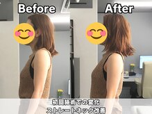整体院 ワン(ONE)の雰囲気（整体、骨盤矯正によるストレートネック改善例となります。）