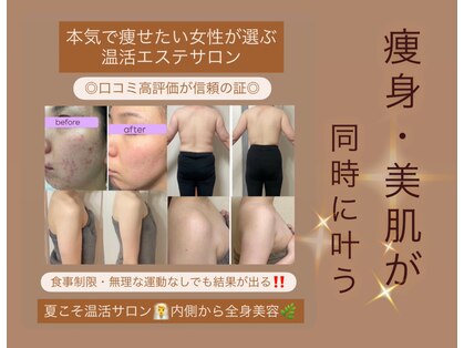 ヨサパーク リアン(YOSA PARK Lien)の写真