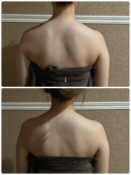 エステティックサロン ベルエトワール住吉店/ウェディングフォトに向けて