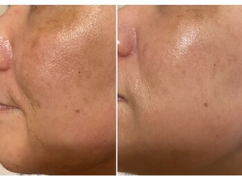 コルッソ(CoLusson.)/お肌は生まれ変わります