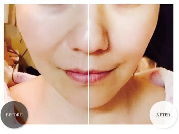 エムグランデ(Mgrande)/瞬間美白磁気パックで美白効果◎