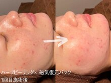 ルーナジェーナ(Luna llena)/