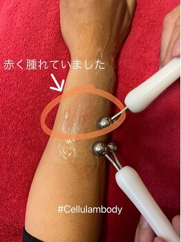 ジュエル シズオカ(JEWEL Shizuoka)/セルラムボディメニュー