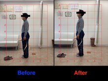 整体院 仁(JIN)/#背部痛#産後腰痛#骨盤の歪み