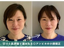 アンビカ