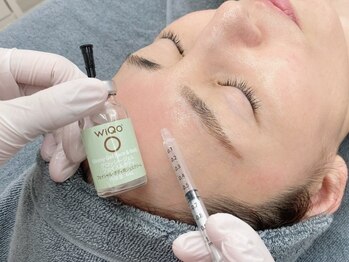 オンビューティー 麻布十番(onBeauty)の写真/話題の肌質改善◎韓国でも人気の《水光艶美肌ピーリングWiQo》ハリ・ツヤ・小顔を手に入れたい方はぜひ☆