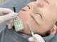 オンビューティー 麻布十番(onBeauty)の写真/話題の肌質改善◎韓国でも人気の《水光艶美肌ピーリングWiQo》ハリ・ツヤ・小顔を手に入れたい方はぜひ☆