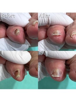 巻き爪補正店 鎌倉大船店/