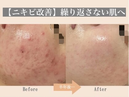リリアス(RILLIAS)の写真