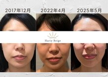 ハリーベージュ(Hariy Beige)
