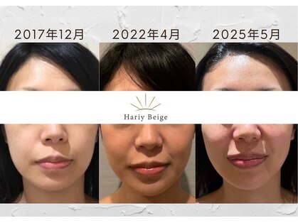 ハリーベージュ(Hariy Beige)の写真