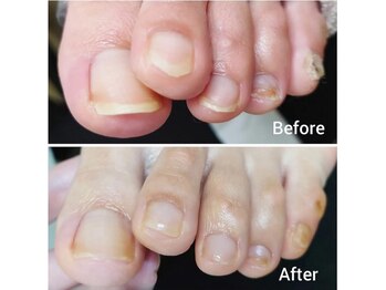 リゼラアンドコー 柏原店/足爪ピカピカケア！