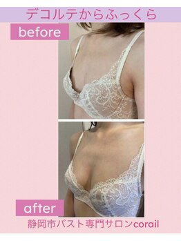 コライユ(corail)/サイズよりも形が気になる方へ