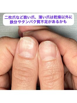 爪のトラブルの大きな原因は乾燥