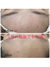 モスト(MOST)/エンビロンフルコース